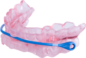 sleep apnea oral appliance